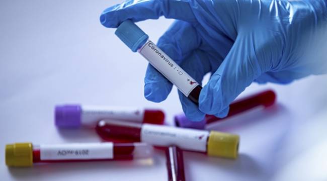 Türkiye'de koronavirüsten son 24 saatte 55 kişi hayatını kaybetti