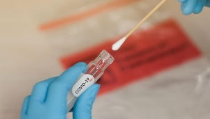 ALİAĞA'DA TURİSTLER COVİD19 TESTİ YAPTIRABİLECEK