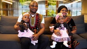 YAPIŞIK İKİZLER TÜRKİYE'DE YENİDEN DOĞDU!