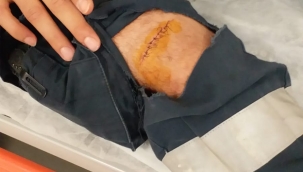 Hastanede   makasla görev başındaki sağlık çalışanını yaraladı