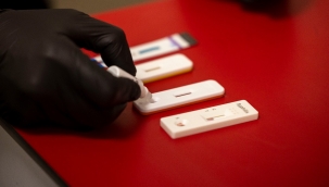 Büyükşehir'den kimliksiz ve ücretsiz test hizmeti